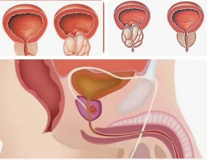 Урологический массаж, массажист