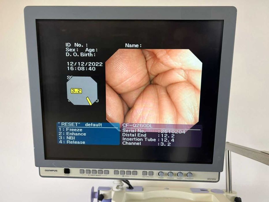 Видеогастроскоп GIF-V70 Olympus