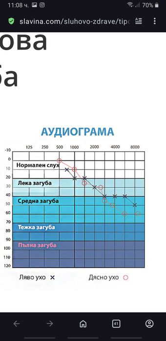 Стар Докторски Уред за мерене на слуха