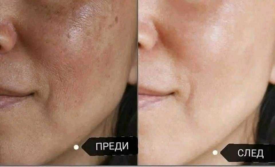 Пилинг лимон - за Вашата чиста кожа месеци наред