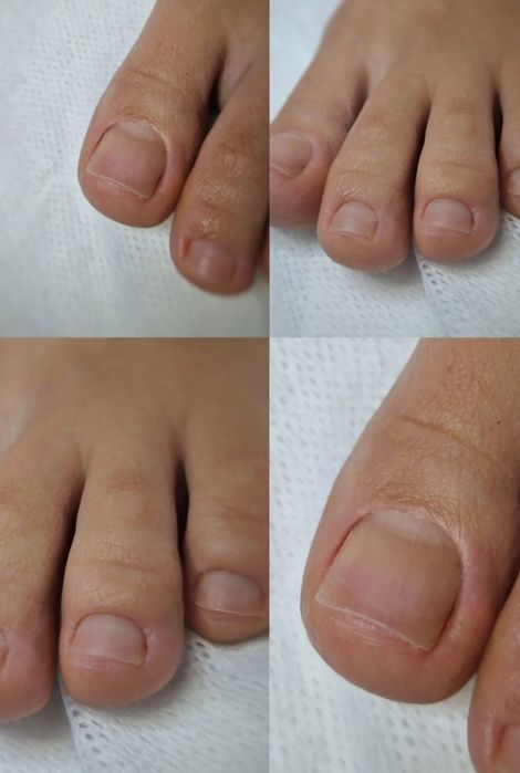 Мужской педикюр, маникюр.