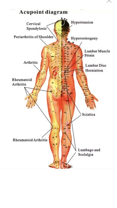 Aparat de fizioterapie, EMS, ultrasunete, laser, Qiaoxin QXTA-C1