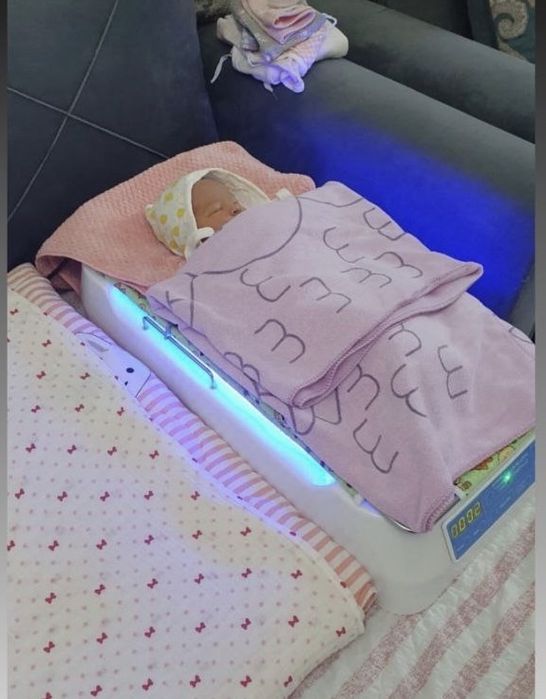 Фотолампа от желтушки, фототерапия, аренда фотолампы