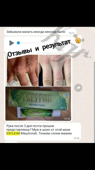 Крем от псиораз,  экзема. Индонезия.