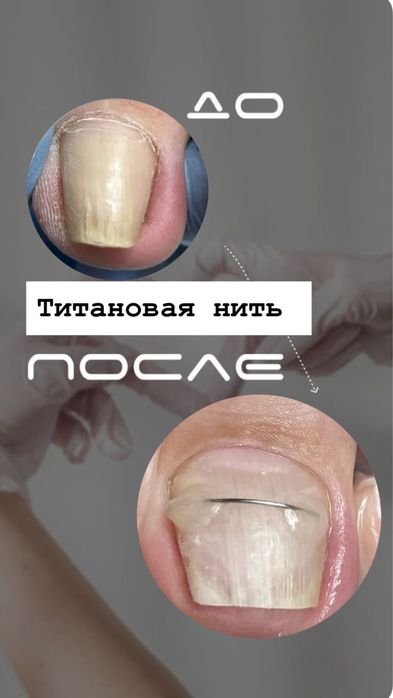 Мастер педикюра-подолог