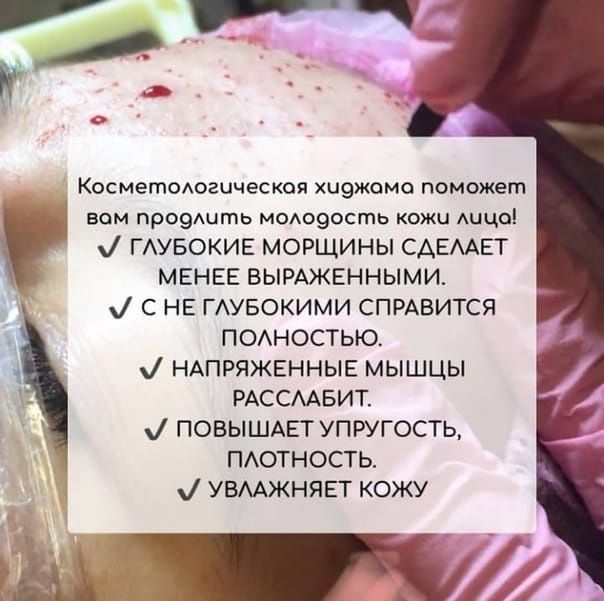 Оздоровительная хиджама.