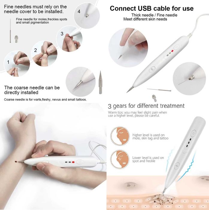 Ручка для удаления бородавок, папиллом, татуировок