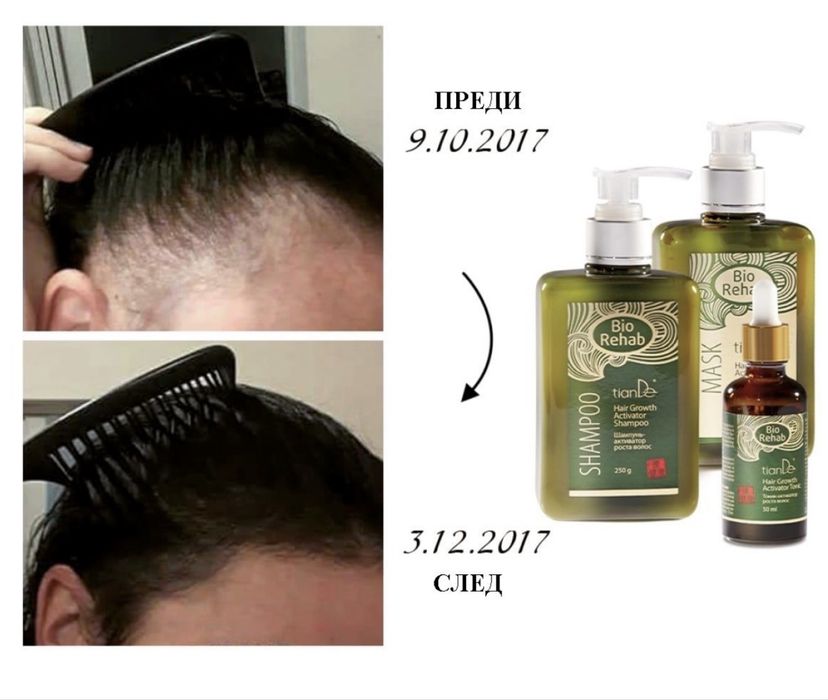 Комплект Bio Rehab за косопад и бърз разтеж на косата