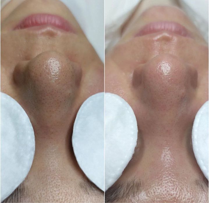 Cosmetologik pratseduralar barchasi mavjud erkak va ayollar uchun!