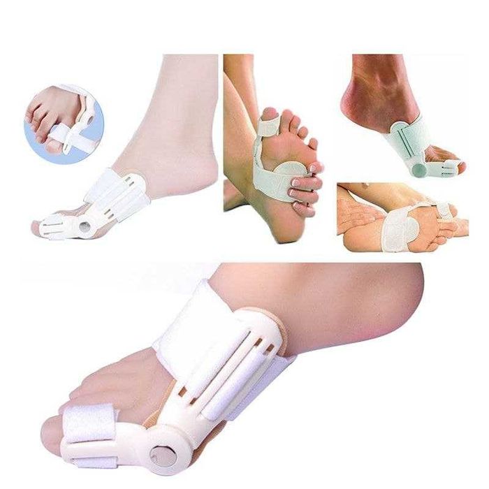 Oyoqdagi qiyshayishni to'g'rilash uchun Fiksator