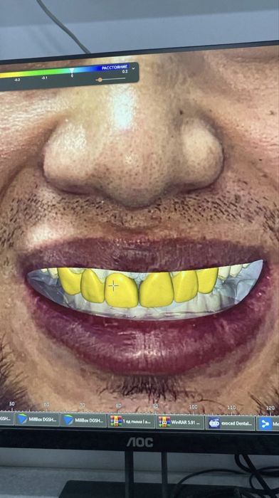 Импланты от 49.999