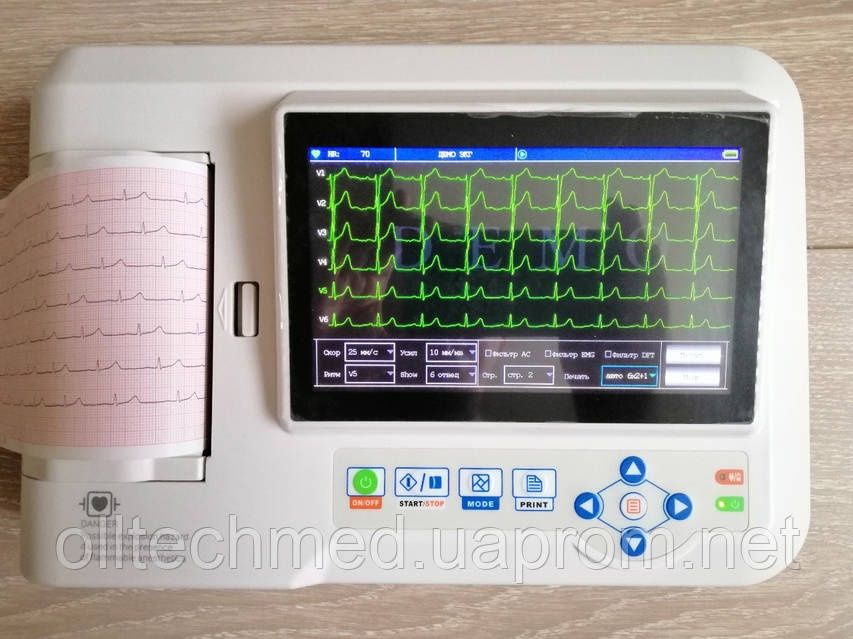 Электрокардиограф