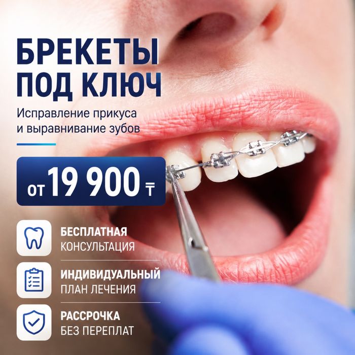 БРЕКЕТЫ  - 19,900тг по акции