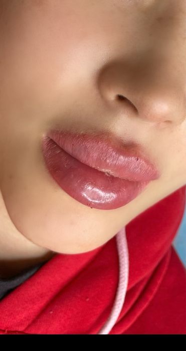 Нужны модели на Увеличение Губ