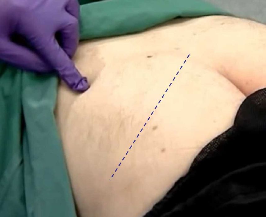 Servicii medicale la domiciliu-jud Neamt