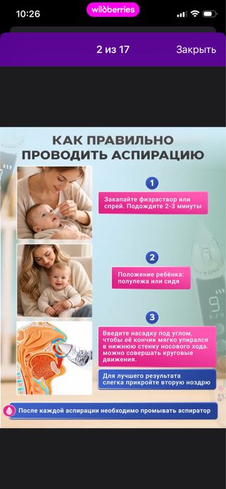 Аспиратор электрический. Соплеотсос