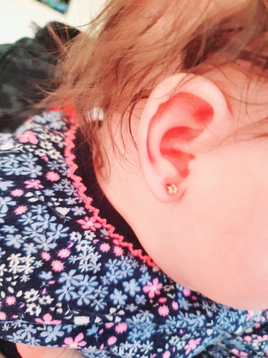 Montare cercei si tratamente injectabile la domiciliu