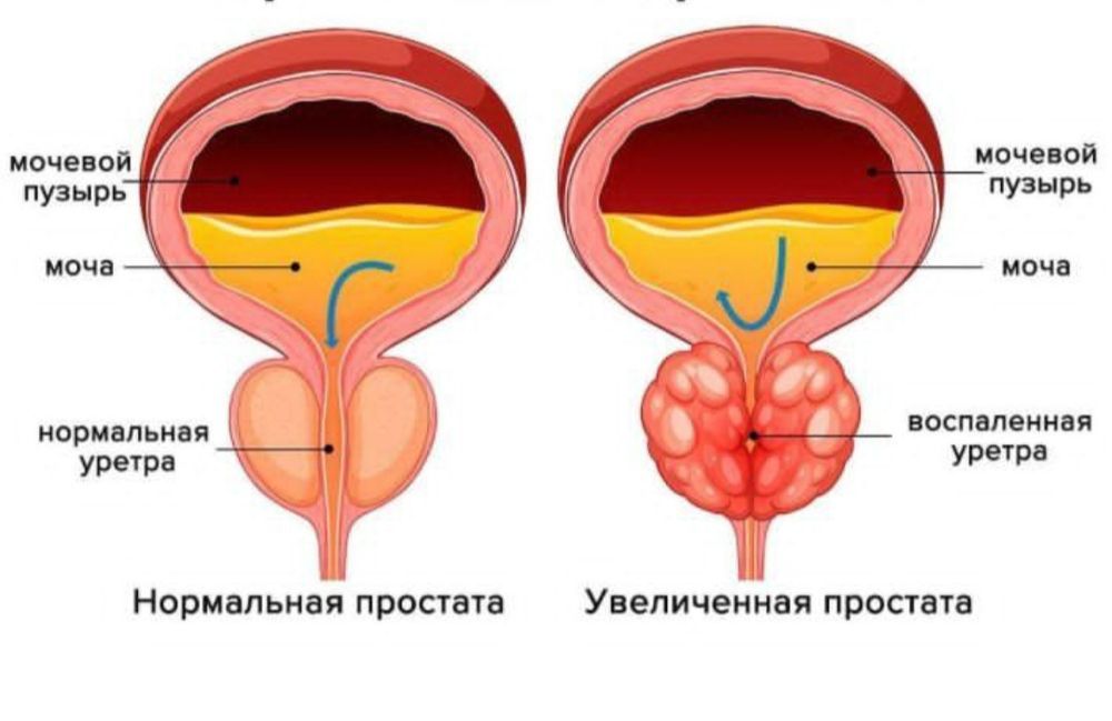 Для профилактики массаж