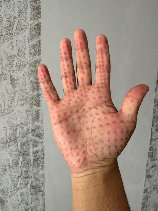 Массажер для рук