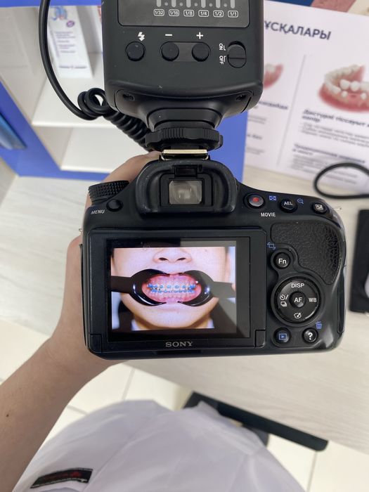 Фотоаппарат стоматологический