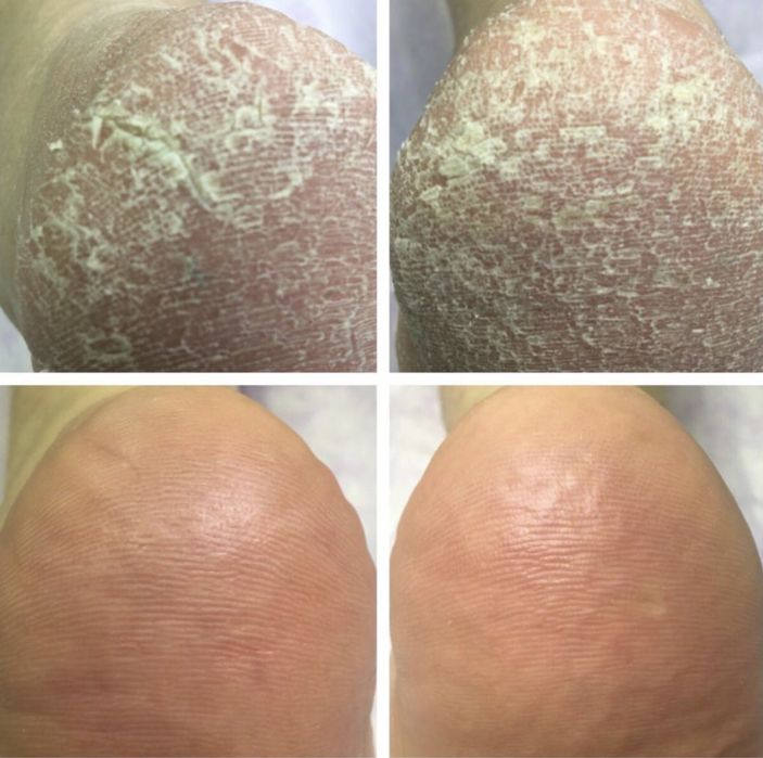 Маникюр, педикюр, шугаринг