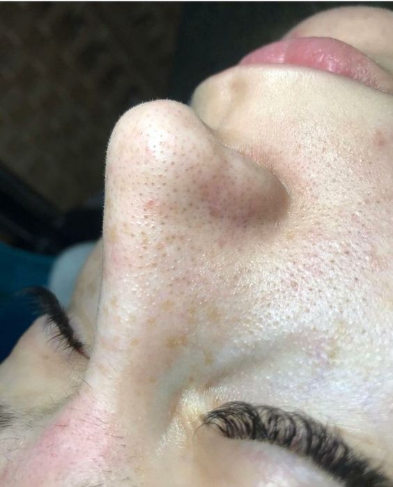 Услуги косметолога