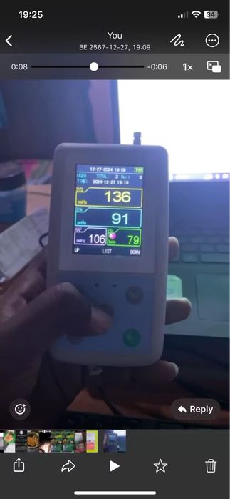 Holter tensiune arterială