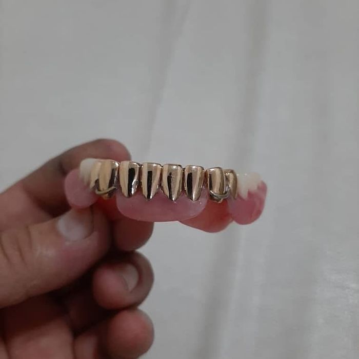 Протез зубной тех