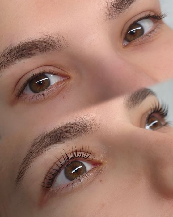 Laminare gene si sprancene Arad