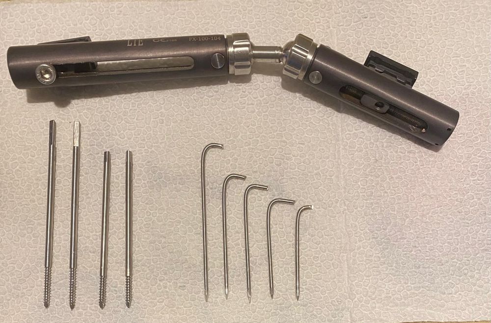 Външен Фиксатора  за счупена китка