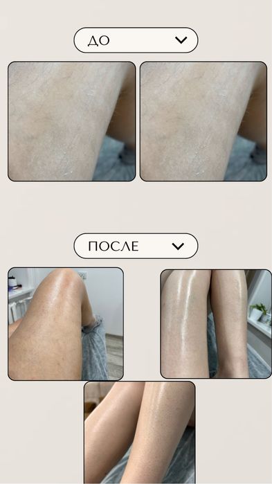 Шугаринг по самым низким ценам