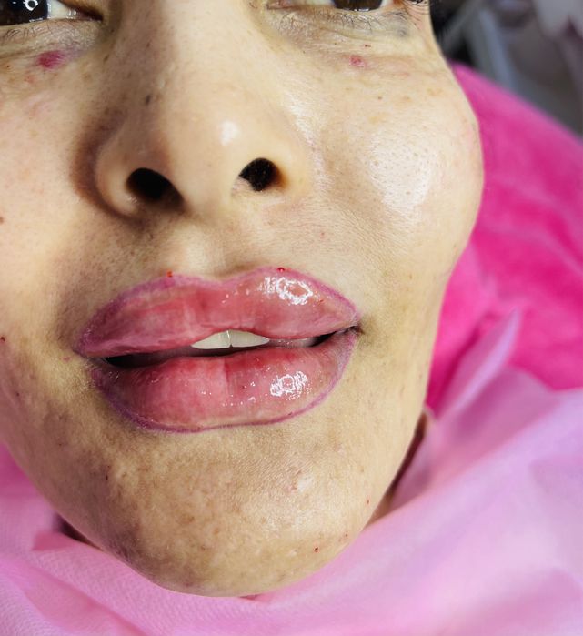 Косметолог шошиламиз кизлажонла декабр ойга  котта скидка