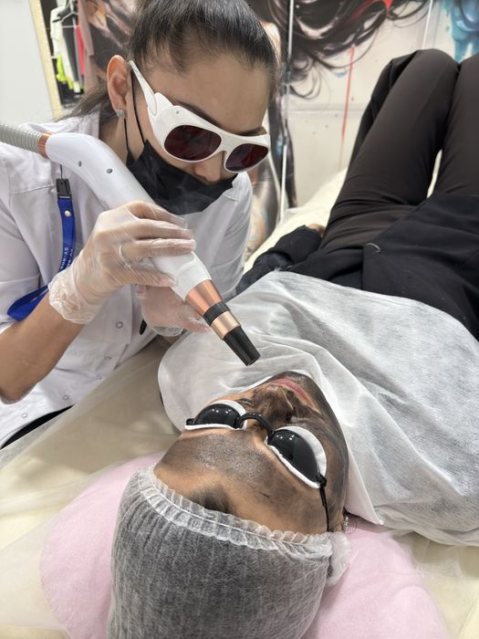 ПРОДАМ профессиональный   лазерный аппарат