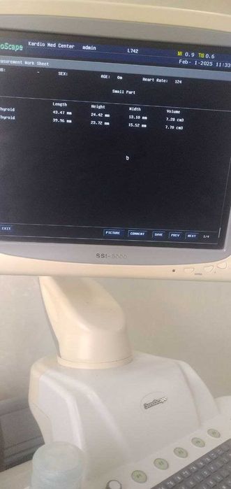 УЗИ аппарат стационар. SonoScape SSI - 8000