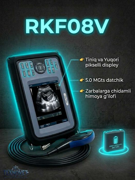 RKF08V portativ (ko'chma) ultratovush tekshiruvi (UZI) apparati