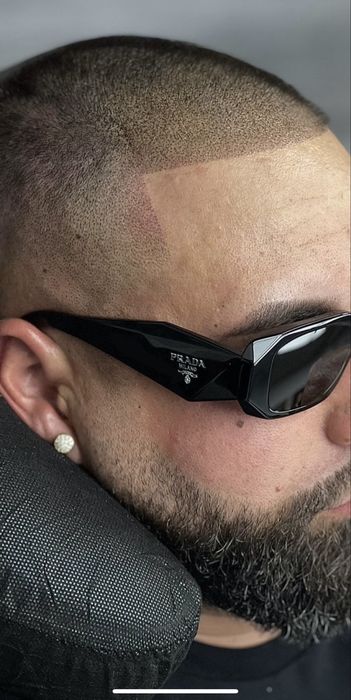 Curs de Micropigmentare Scalp și Barba - Dermopigmentare SMP Academie