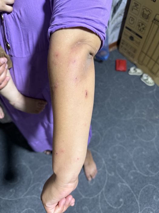 Dezinfeksiya dezinseksiya deratizatsiya xizmati 24/7