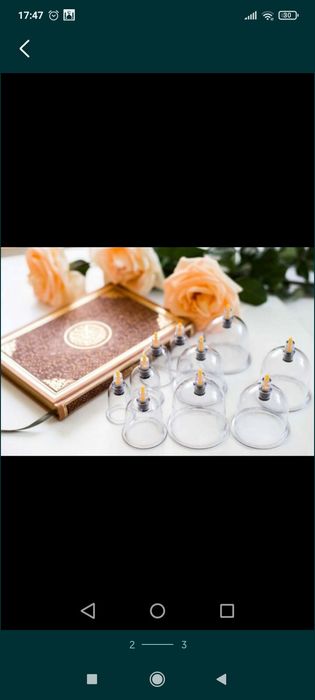 Хиджама кровопускание