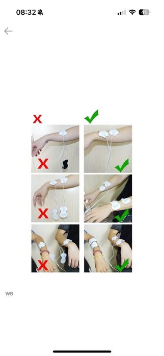 Электрофорез