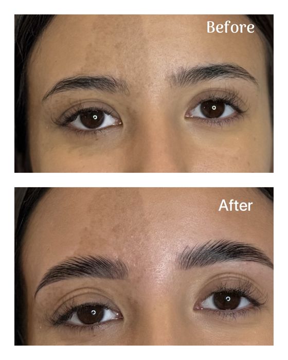 Laminare gene si sprancene