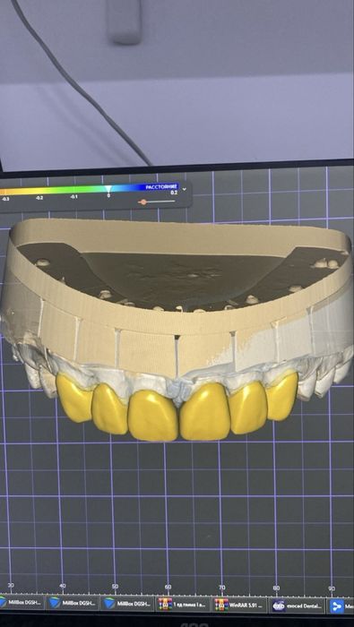 Импланты от 49.999