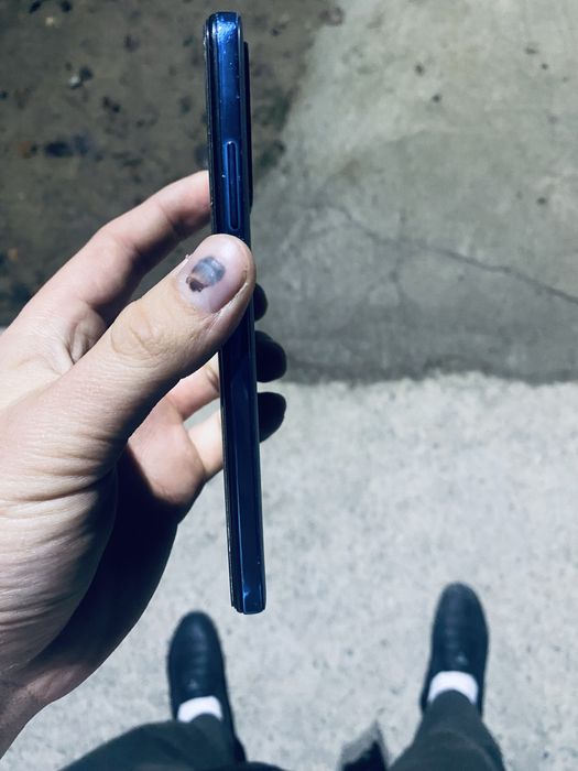 Redmi note 11 srochna