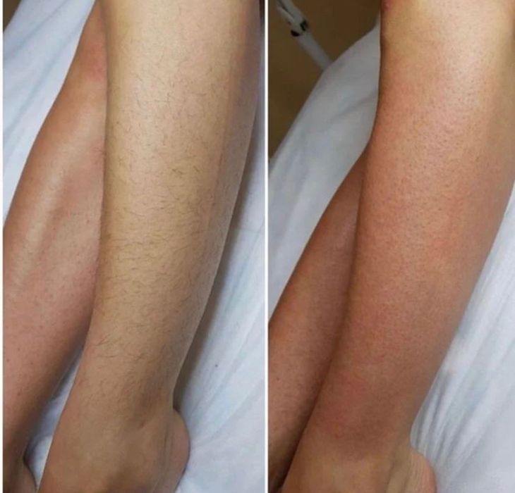 Шугаринг полимер воск