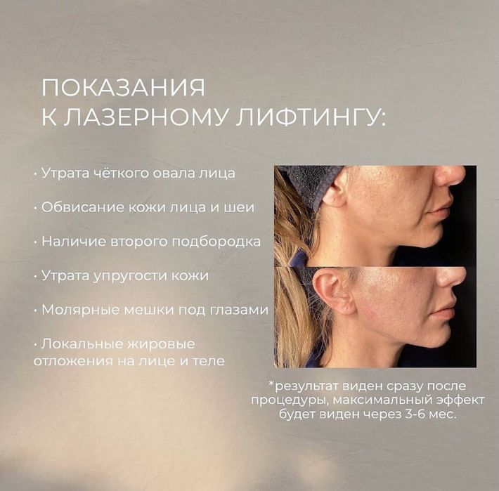 Аппарат Эндолифт
