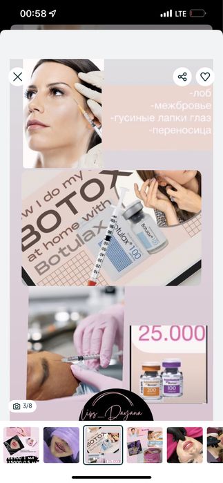 Увелечение губ . Косметолог