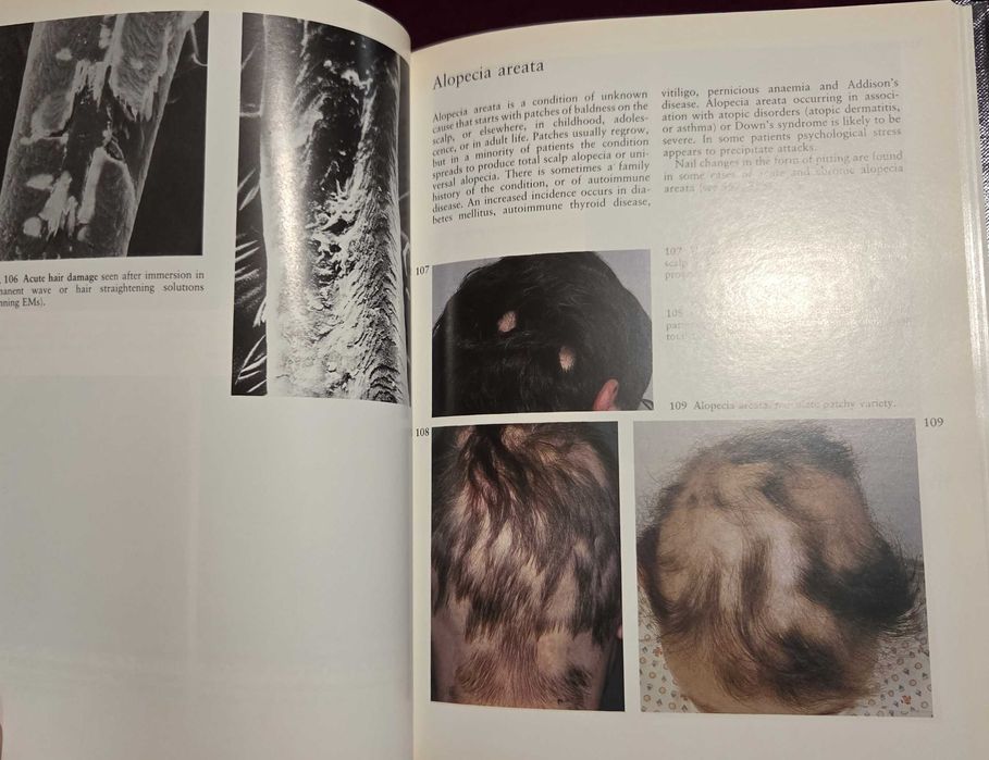 A Colour Atlas of the Hair, Scalp and Nails