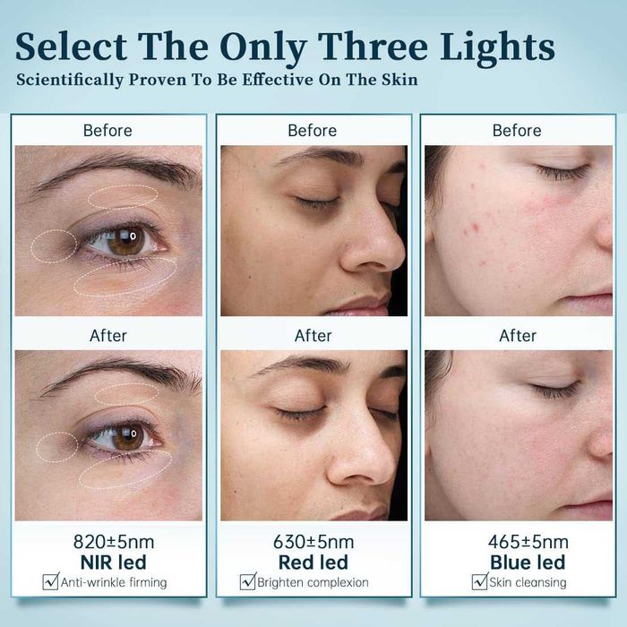 LED маска за лице GYH Cloud-S