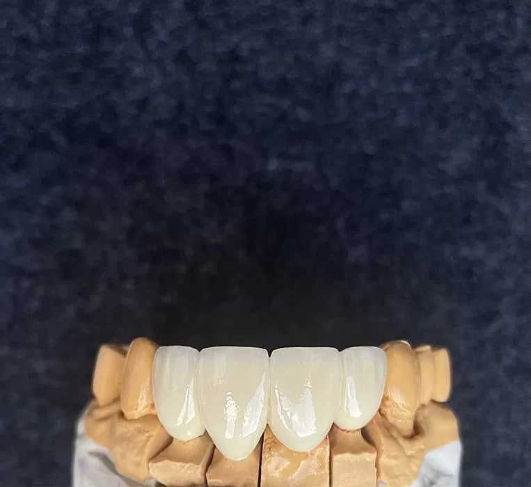 CAD/CAM – компьютерное моделирование зуботехнические услуги