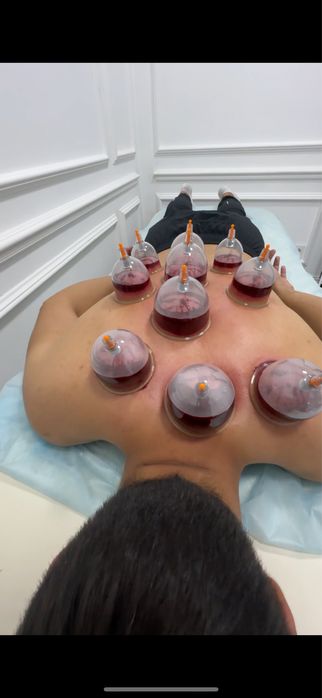 Хиджама 7000тг в подарок мануальная терапия