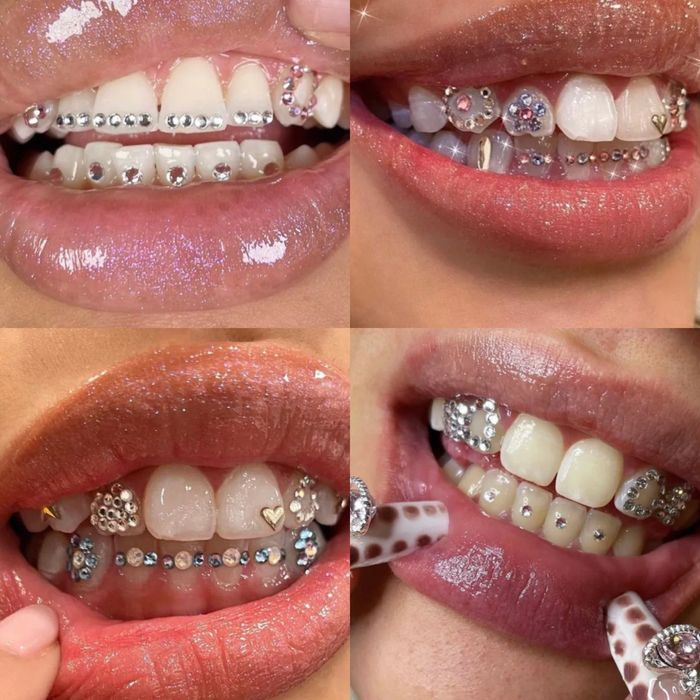 Бижута за Усмивка: DIY Комплект за Декорация на Зъби | Tooth Gem Kit
